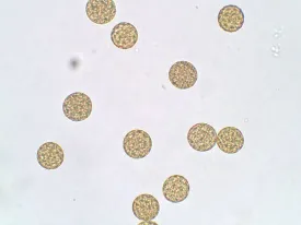 WALTER POLLEN & SPORES PREPARED SLIDE SET